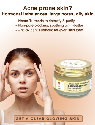 Parama Naturals Clarifying & Soothing Face & Body Cream For Acne-Prone Sensitive Skin, 31g