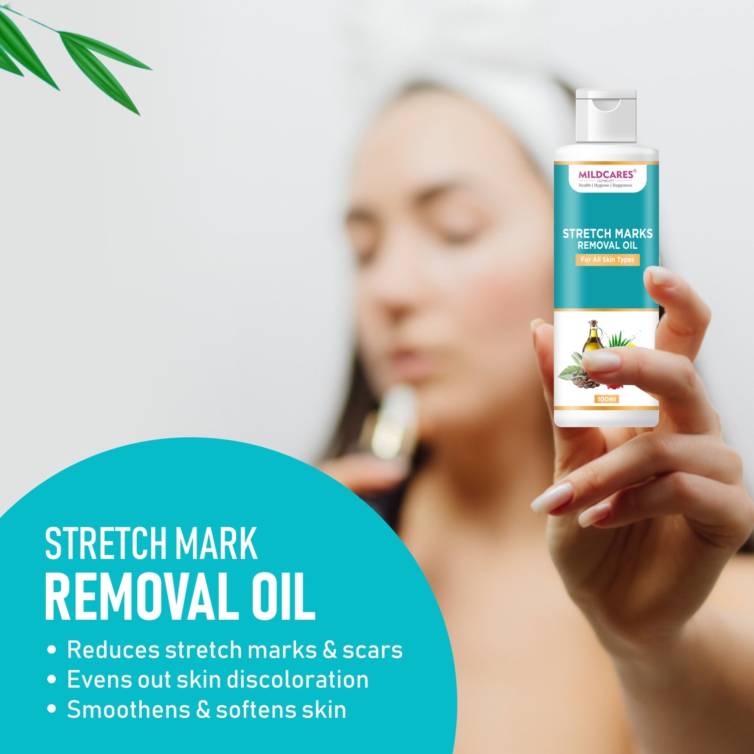 Mildcares Stretch Mark Removal Oil (100ml) With Goodness of Sunflower Oil, Vitamin C