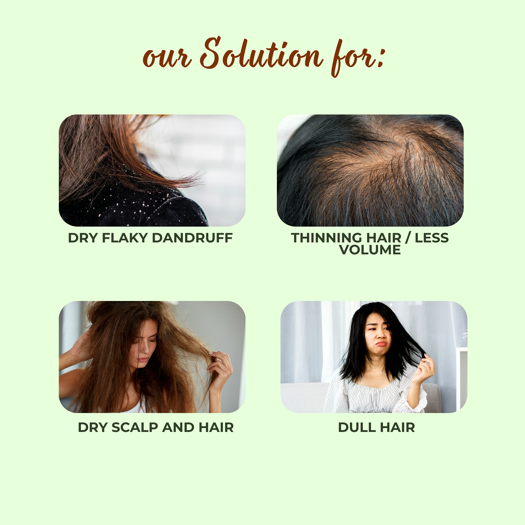 MrilQ Root Logic | Hair Mask | Controls Dry Dandruff | Control Hair fall | Soothes irritated scalp