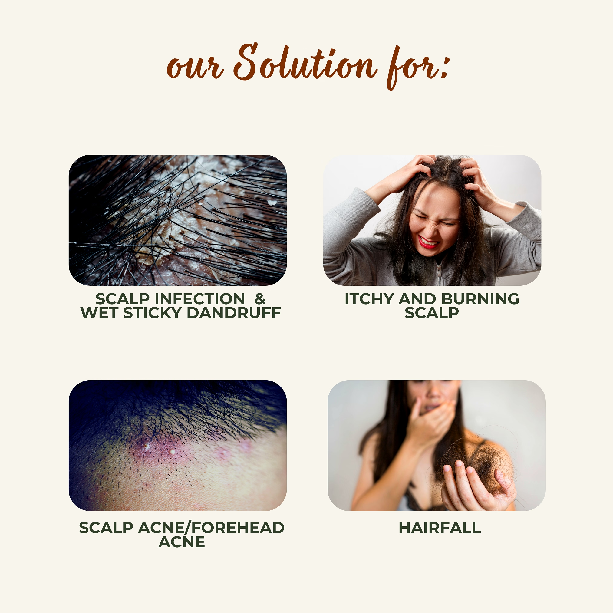 MrilQ Root Basic | Hair Mask | Heals Scalp Infection | Controls Wet Dandruff | Control Hair fall | Nourishes Hair